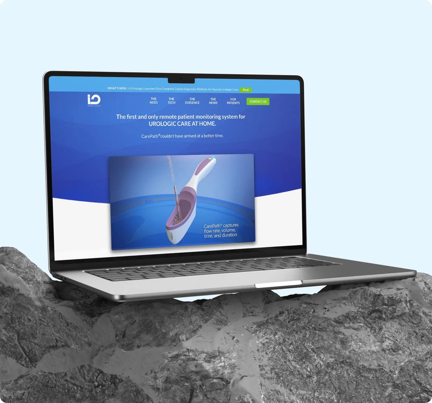 I-O Urology remote patient monitoring platform shown on a laptop